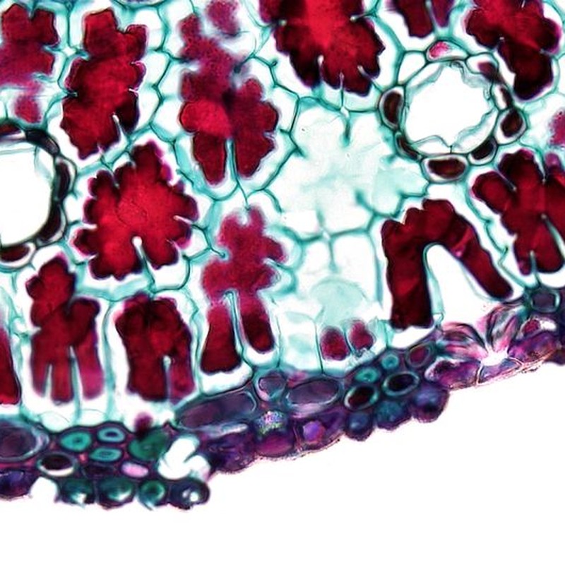 Bright and colorful microscopic view of plant cells with red and green structures on a white background.