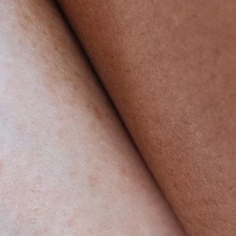 Backdrop of textured bare skin surface of crop unrecognizable multiracial people close to each other